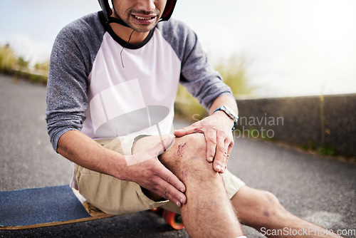 Image of Injury, man and knee pain after skateboarding accident, practice and learning to skate. Active, bad and skateboarder with a bruise, broken bone or holding a painful leg in the street while skating