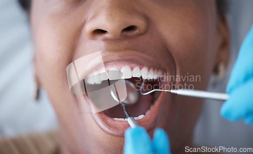 Image of Checkup, teeth and woman with a dentist for oral hygiene, cavity check or cleaning mouth. Zoom, dental and doctor with mirror to look at the tooth of a girl for healthcare, treatment and examination