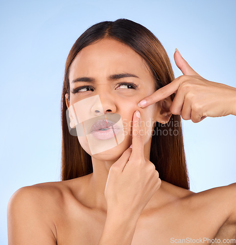 Image of Beauty, cosmetics and woman squeeze pimple, skincare and girl with breakout against blue studio background. Female, lady and model with acne, grooming and treatment with facial scar and dermatology