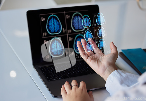 Image of Brain x ray graphic, clinic results and doctor hands with digital report about neurology work. Anatomy, xray and assessment data with a healthcare employee holding mri test information in a hospital