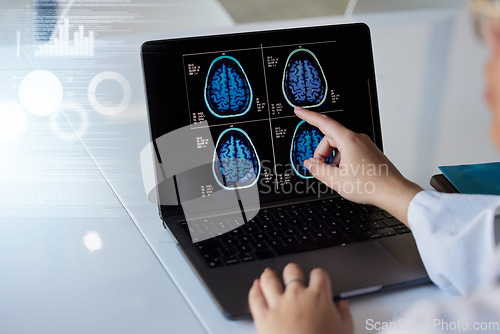 Image of Brain x ray, computer results and doctor hands with digital report graphic about neurology. Anatomy, xray and assessment data with a healthcare employee with mri test information in a hospital