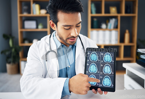 Image of Brain x ray, video call and doctor with a tablet for advice, healthcare results and showing scan. Education, teaching and an Asian medical worker pointing to radiology research on tech for a webinar