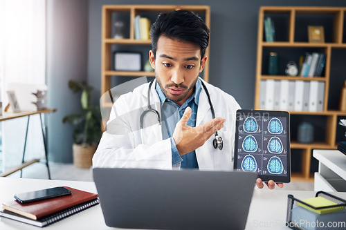 Image of Mri, man and doctor on video call, talking and healthcare with telehealth, diagnosis and analysis for care. Male employee, medical professional or surgeon with tablet, brain scans or explain solution