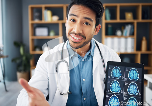 Image of Portrait, Asian man and doctor with tablet, mri results and explain diagnosis in office, conversation and healthcare. Face, medical professional and employee with device, brain scan and neurology