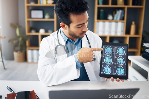 Image of Neuroscience, man and doctor with scans, explain diagnosis or healthcare in workplace. Male consultant, employee or medical professional with tablet, talking or analysis for solution or brain results