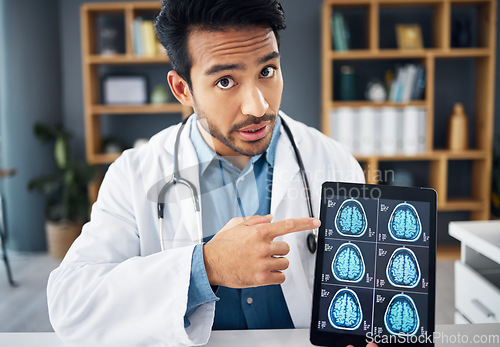 Image of Brain x ray, video call and portrait of doctor with a tablet for healthcare results and showing scan. Analysis, teaching and Asian medical worker pointing to radiology research on tech for a webinar