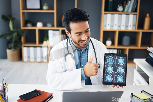 Image of Video call, x ray and doctor with brain scan on tablet for telehealth, online consulting and patient results. Healthcare tech, communication and man on computer for medical care, neurology or service