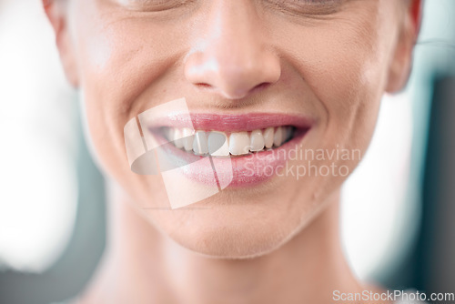 Image of Woman, teeth and smile for dental care, surgery or healthcare hygiene and healthy wellness. Closeup of happy female face and mouth smiling for tooth whitening, oral or dentist treatment and grooming