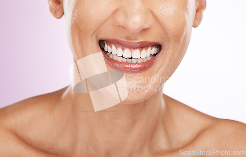 Image of Face, smile and dental teeth of woman with veneers, smiling or tooth whitening in studio isolated on a purple background. Oral health, skincare makeup and lip cosmetics of happy female with beauty.