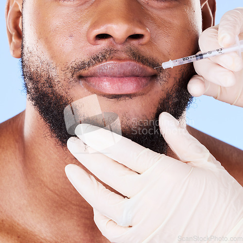 Image of Man, plastic surgery and needle in studio for lips, filler and beauty for face transformation by background. African patient, model or surgeon hands for skincare, syringe or dermatology for aesthetic