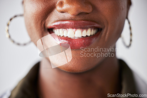 Image of Smile, happy and mouth closeup of black woman with teeth whitening, dental care and wellness. Healthcare, dentistry and face zoom of female person with cleaning for hygiene, grooming and treatment