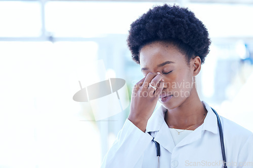 Image of Headache, doctor and stress with black woman at the hospital, clinic or working with burnout, fatigue or pain in head. Frustrated, person and problem with mental health, healthcare or migraine