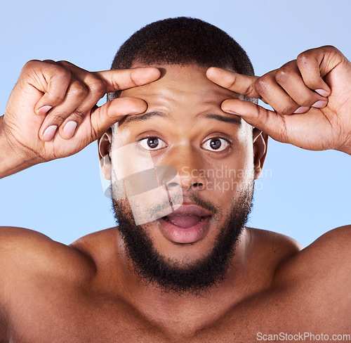 Image of Aging, anxiety and black man portrait in studio for skin, check and beauty routine on blue background. Skincare face, worry and African male model surprised by fine lines, fail or dermatology problem