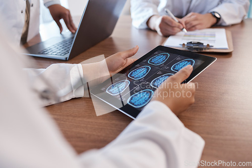 Image of Doctor, tablet screen and hands of person with brain scan MRI, cancer tumor results and consulting on digital xray data. Closeup teamwork, radiology and neurosurgeon collaboration on anatomy exam