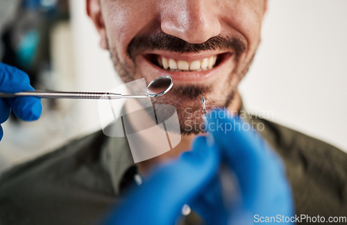 Image of Smile, man and hands of dentist with tools for dental, healthcare or check in clinic. Tooth wellness, orthodontics and patient with doctor, mirror and excavator for teeth cleaning and medical hygiene