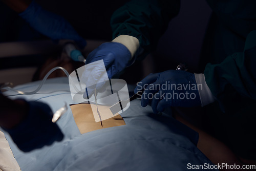 Image of Surgeon hands, person and surgery operation, emergency service or help patient in dark room. Healthcare tools, operating theatre and closeup doctors doing medical procedure on client anatomy at night