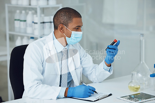 Image of Science, medical and man with blood work for doctor research and study in clinic. Lab expert, analysis and healthcare professional with hospital notes and writing for laboratory test of scientist