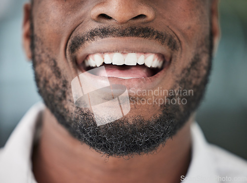 Image of Dental, smile and mouth of man closeup for cosmetic, care and oral hygiene treatment results. Happy, teeth whitening and male person confident, breath or tooth cleaning, bleaching or satisfaction