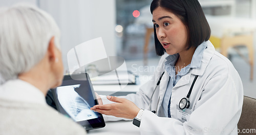 Image of Tablet, xray and patient in consultation with doctor, medical results and analysis, advice on health diagnosis. Chest, anatomy and radiology, communication and women in office, surgery and healthcare