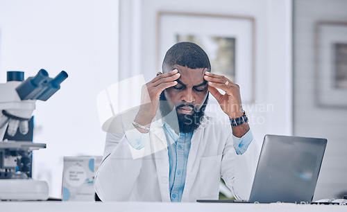 Image of Headache, stress and tired man with burnout from science, research mistake and laptop error in laboratory. Sick, sad or frustrated african scientist with pain, migraine and fatigue for mental health