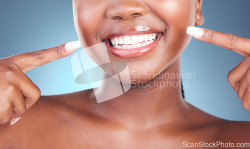 Image of Happy woman, teeth and pointing in dental cleaning, hygiene or treatment against a blue studio background. Closeup of female person mouth in tooth whitening, oral and gum care with big smile