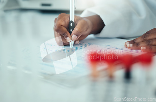 Image of Results, hands or woman scientist writing research notes for analysis on experiment or medical paperwork. Notebook, closeup or expert in a laboratory with documents info for science development