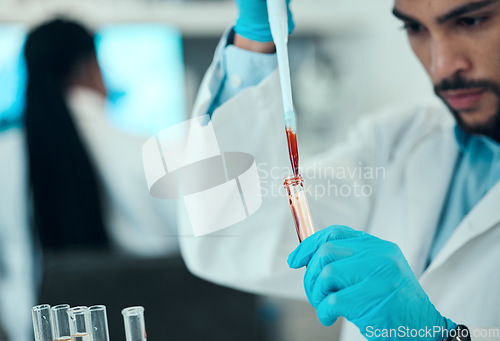 Image of Scientist, man with blood in pipette and test in laboratory research, results and medical engineering. Biotechnology, pharmaceutical study and DNA lab technician with liquid solution in glass.
