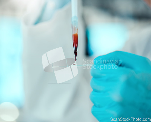 Image of Hands of scientist with blood in pipette, glass and laboratory research, dna results and medical engineering. Biotechnology, pharmaceutical study and lab technician with solution for pathology test.