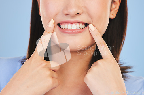 Image of Woman, clean smile and point in studio closeup for dental healthcare, teeth whitening or happy by blue background. Girl, mouth and excited for beauty, transformation and tooth wellness for hygiene