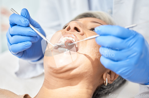 Image of Woman, mouth and dentist hands with tools, medical and dental procedure, healthcare and closeup. Oral health, orthodontics and patient with doctor, teeth whitening and veneers with metal instrument