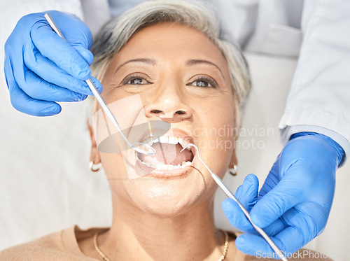 Image of Healthcare, consulting and teeth with woman at dentist for oral hygiene, cleaning and medical. Exam, dental checkup and smile with mouth of mature patient in office for filling, surgery and treatment