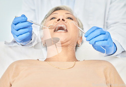 Image of Tools, mature woman and hands of dentist in healthcare, check and dental wellness in clinic. Oral, orthodontics and patient with doctor, mirror and excavator for teeth cleaning and medical hygiene