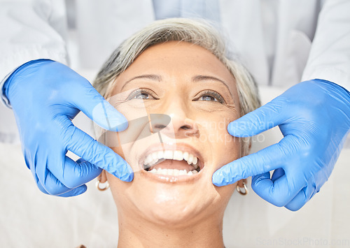 Image of Senior woman, mouth and dentist hands with dental procedure, medical and healthcare with closeup. Oral health, orthodontics and patient with doctor, teeth whitening and veneers with assessment