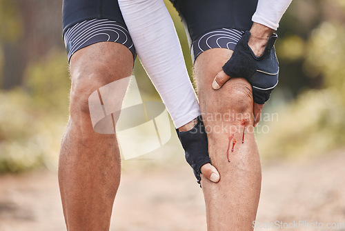 Image of Fitness, knee pain and man with blood, injury or sports mistake in park for cycling, training or exercise accident. Bleeding, wound and cyclist with biking fail, joint or leg emergency or broken bone