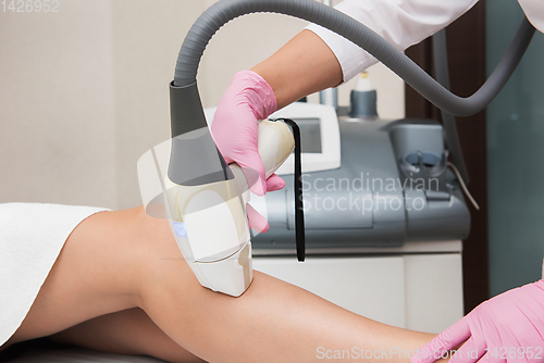 Image of Hair removal procedure