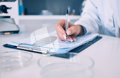 Image of Science, hand of woman in laboratory and checklist with results, inventory list and pharmaceutical study. Research, medical notes and scientist in lab writing on clipboard, analysis and information.