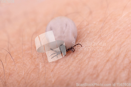 Image of Tick (Ixodes ricinus) isolated on white