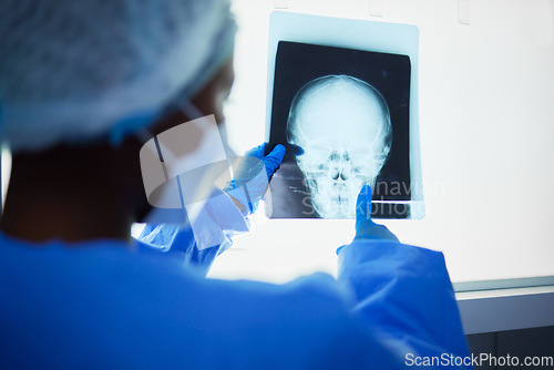 Image of Brain xray, medical doctor and surgery charts, test results and healthcare analysis of the head. Radiology, neurology and surgeon check skull x ray, anatomy and review mri for hospital operation