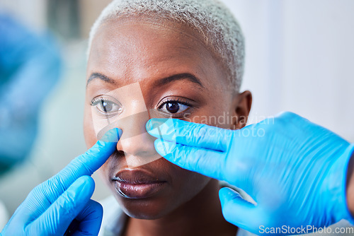 Image of Doctor hands, woman and plastic surgery for cosmetics, aesthetic and facial transformation or nose job. Medical worker with rhinoplasty of african patient or client face, dermatology help or support