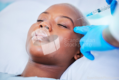 Image of Plastic surgery, injection and black woman on a hospital bed with dermatology with mockup space. Surgeon, facial change and medical filler for skincare, syringe and wellness in a clinic with doctor