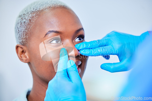 Image of Doctor hands, woman and rhinoplasty for nose job, cosmetics and aesthetic transformation or change. Medical, surgeon and plastic surgery of african patient or client face, dermatology help or support