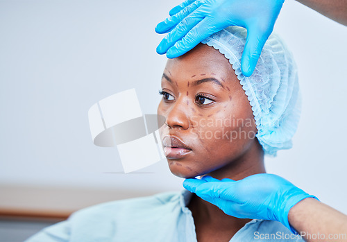 Image of Black woman, patient and doctor hands, plastic surgery and check face, health and medical consultation with beauty. Help, medicine and cosmetic procedure, exam and healthcare with people at hospital