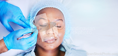 Image of Plastic surgery, pen and black woman sleep on a hospital bed with dermatology with mockup space. Surgeon, facial change and medical filler for skincare, cosmetics and wellness in a clinic with doctor