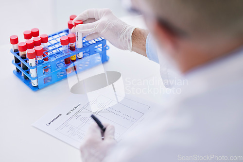 Image of Science, blood sample and hands with test tube and notes for research, medical study and DNA in lab. Healthcare, pharmaceutical and scientist with vial writing for data analysis, report or checklist