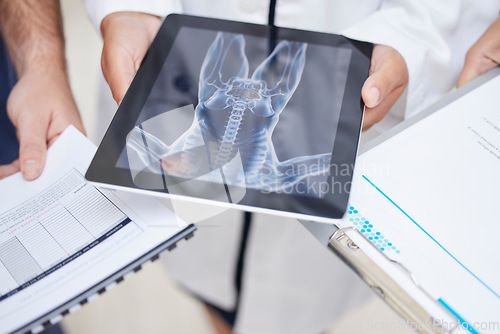 Image of Doctor, hands and tablet with x ray in anatomy, surgery or results in MRI, CT or body scan at hospital. Closeup of medical professional team with technology or documents in patient analysis at clinic