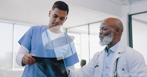 Image of Doctor, nurse and xray with men and health consultation, advice and help with healthcare discussion and cardiology. Medical talk, hospital and team with collaboration and surgery with cardio surgeon.