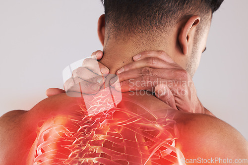 Image of Man with a spinal injury, pain or accident with backache holding his neck in the studio. Scoliosis, sprain muscle and male with a spine or body medical emergency problem by a gray background.