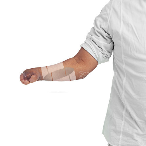 Image of Hand, disability and mockup with a man in studio isolated on a white background after an accident or injury. Medical, deformity and amelia with a disabled male on a blank space for awareness