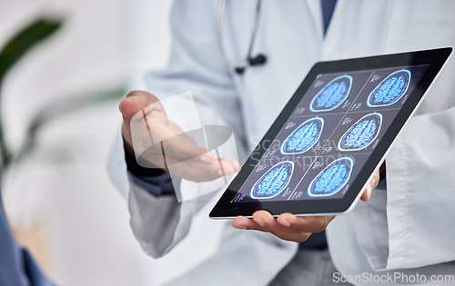 Image of Neurology, healthcare and doctor with tablet in hands for brain research, test results or cancer innovation in hospital or clinic consultation. Medical worker on digital technology for MRI assessment