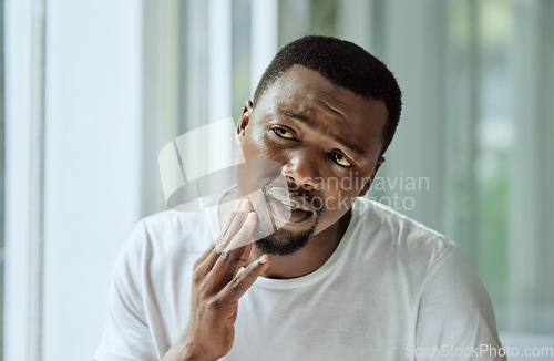 Image of Sad, aesthetic and anxiety of black man with acne confused with face analysis in home bathroom mirror. Unhappy skincare man checking pimple problem in reflection with morning grooming routine.